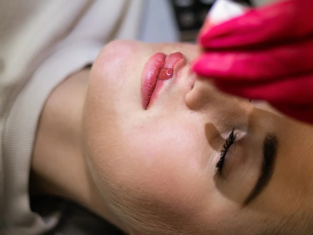 Kiedy odpadną strupki po makijażu permanentnym? Proces gojenia